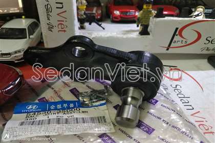 Rotuyn trụ đứng - 517602S000